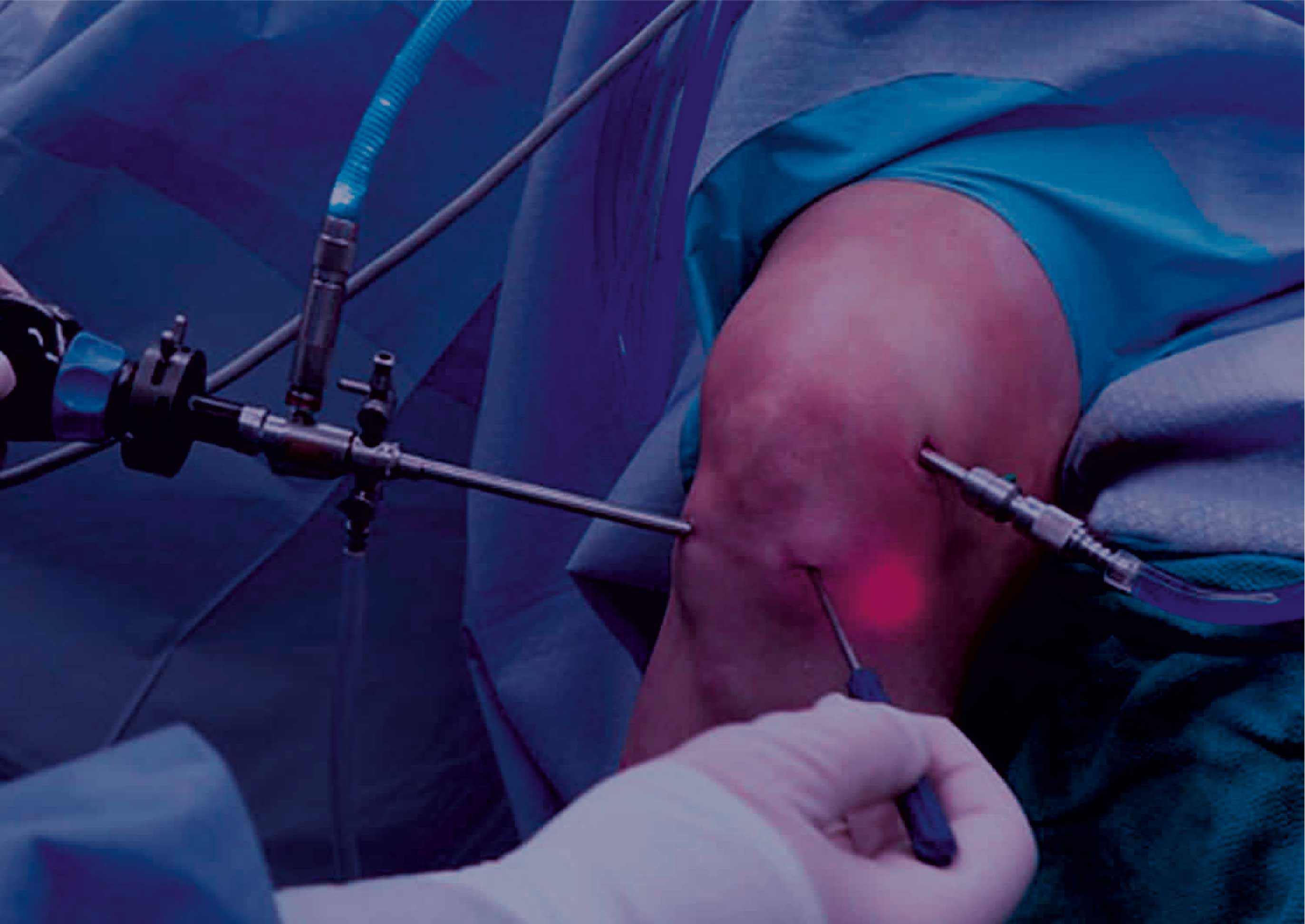 surgery